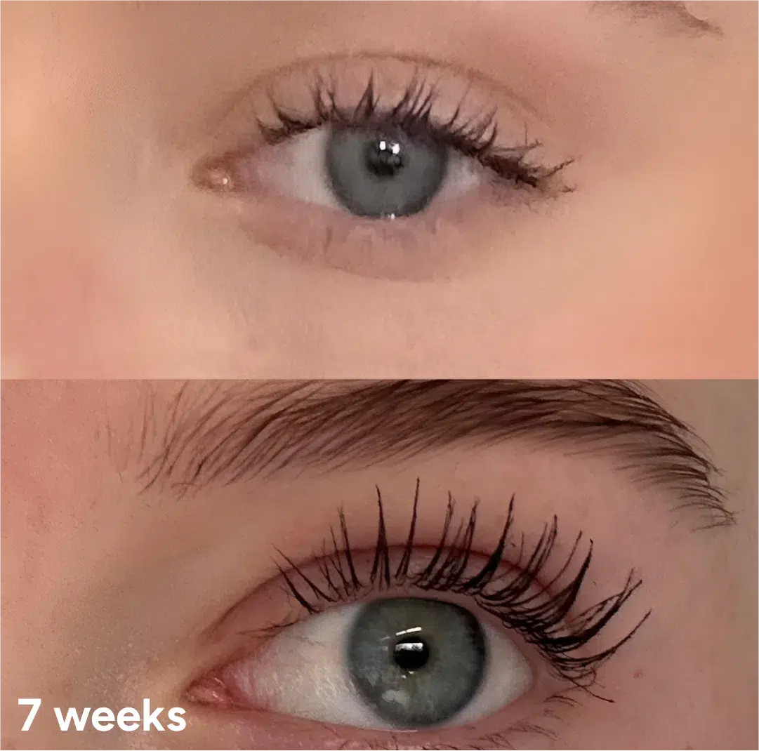 Significant lash growth and improved volume after 7 weeks of using the Lashy Eyelash Serum.