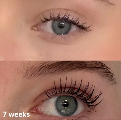 Significant lash growth and improved volume after 7 weeks of using the Lashy Eyelash Serum.